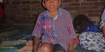 Derita Lumpuh, Fahril Butuh Kursi Roda