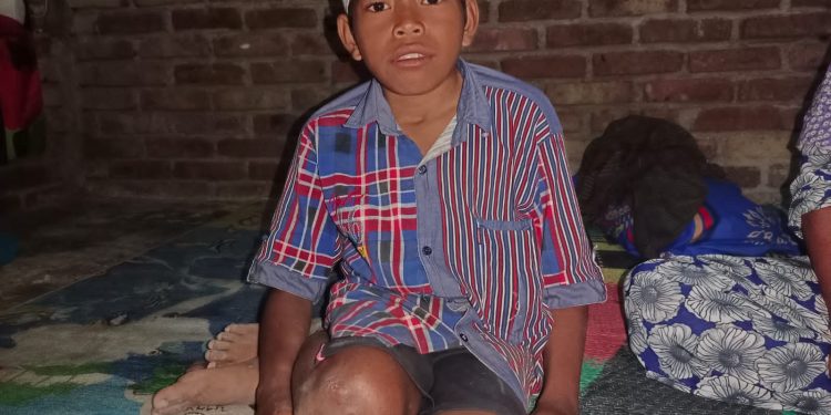 Derita Lumpuh, Fahril Butuh Kursi Roda